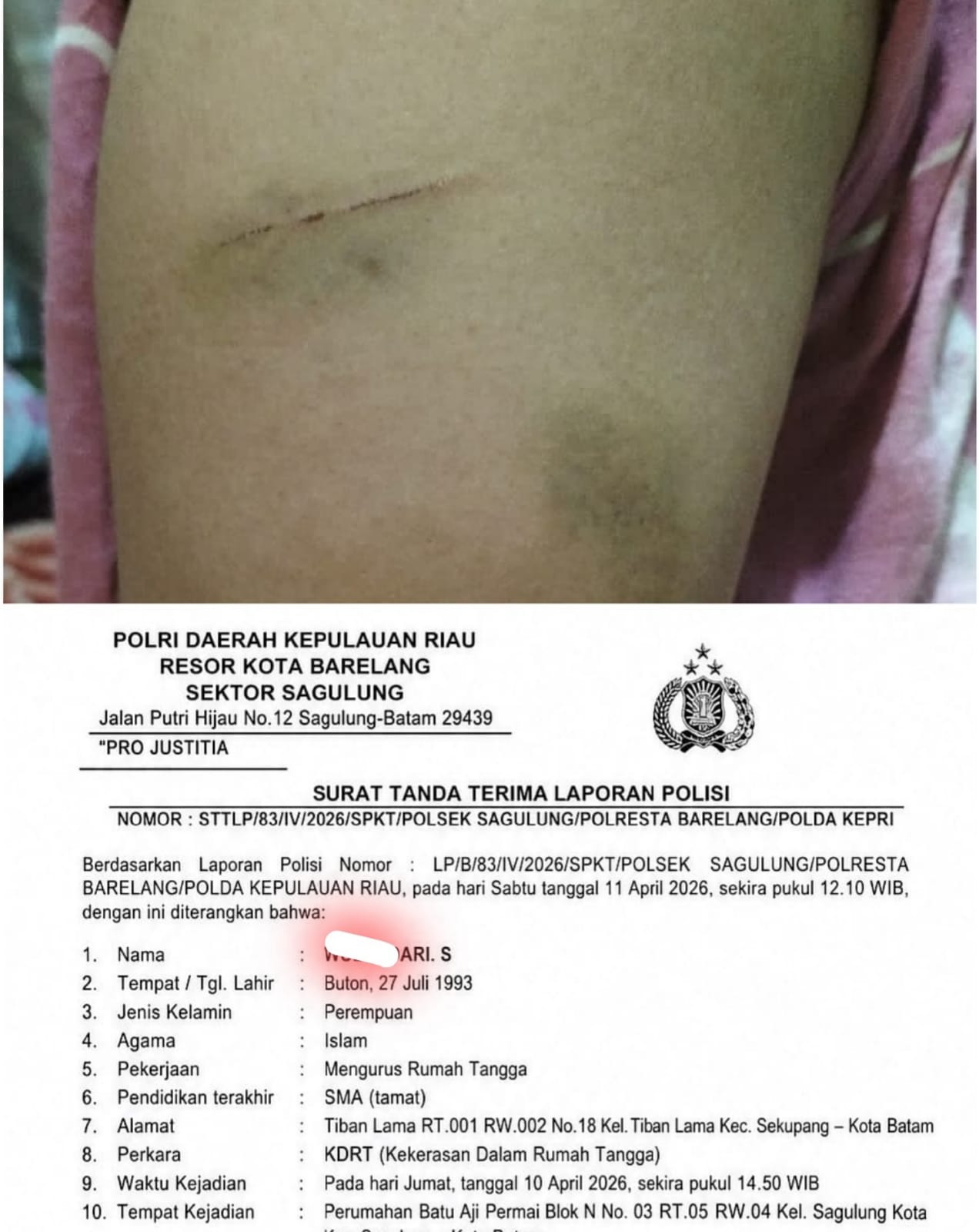 Laporan Kasus KDRT di Polsek Sagulung Terpenuhi Unsur, Korban Minta Pelaku Ditangkap